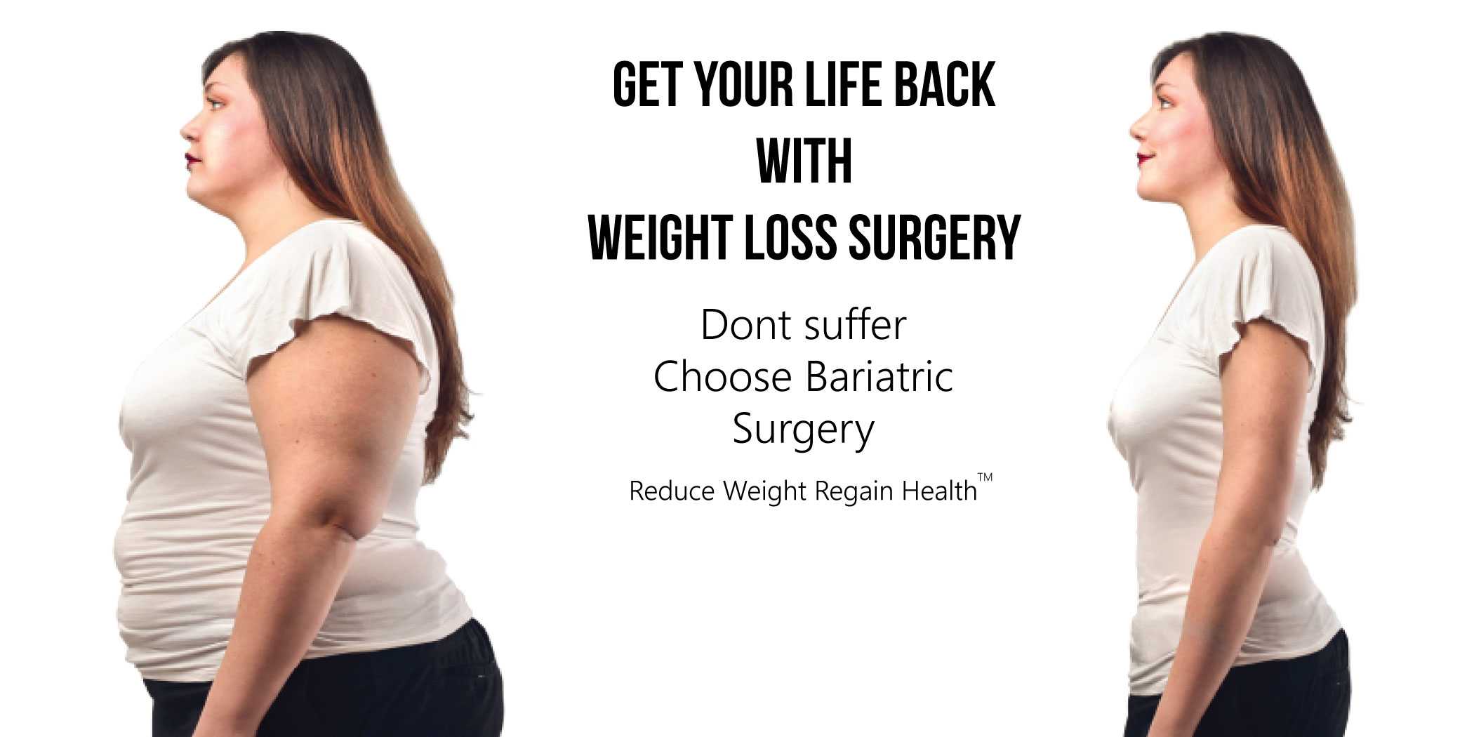 Best Obesity and Bariatric Surgery in India, Gujarat, Ahmedabad