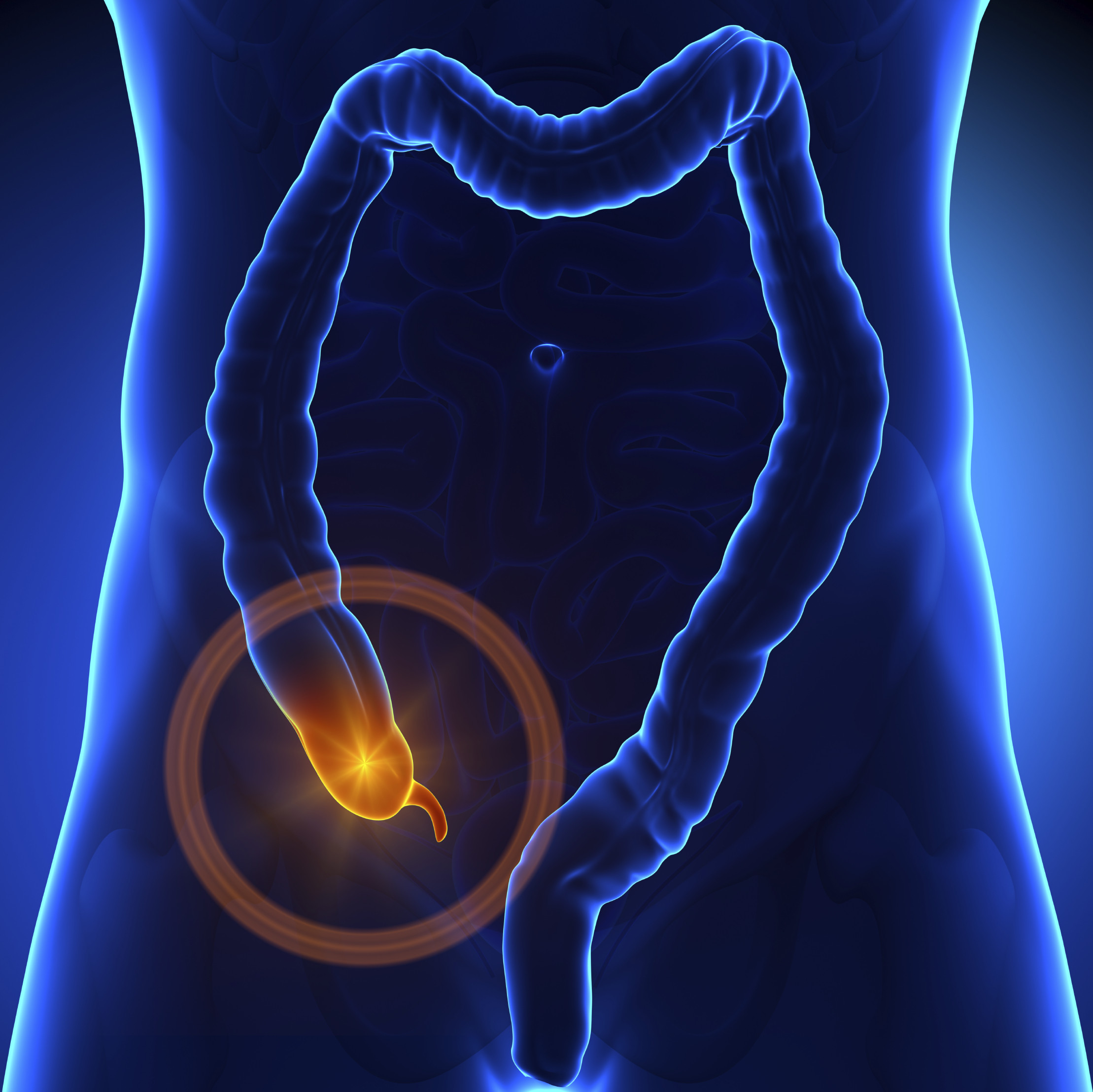 Appendicitis- Risk Factors, symptoms, test and diagnosis