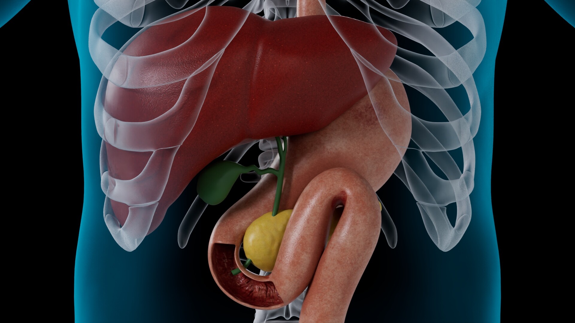 Cholangiogram- Purpose, Procedure and Results