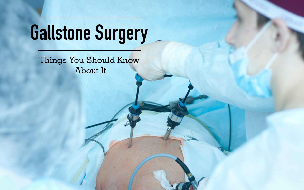 Gallstone surgery how to prepare for it