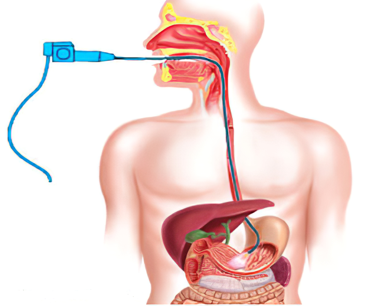 Gastroscopy- Procedure, Risks and Results