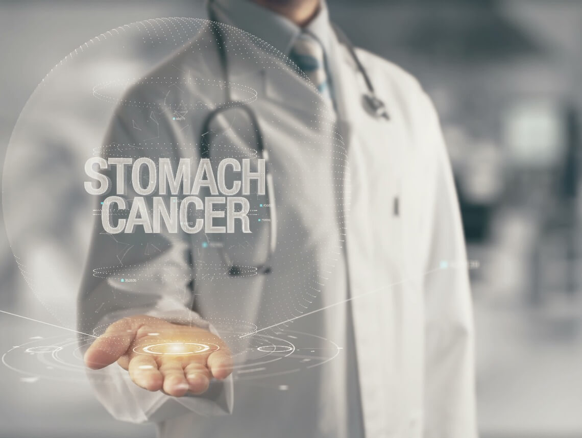 Stomach Cancer Treatment- Surgery, Chemotherapy, Radiation and Biologicals