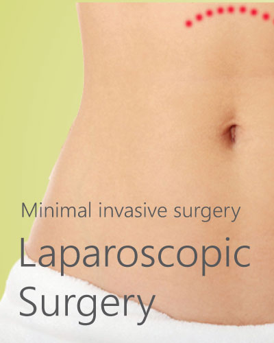 Laparoscopic Surgery