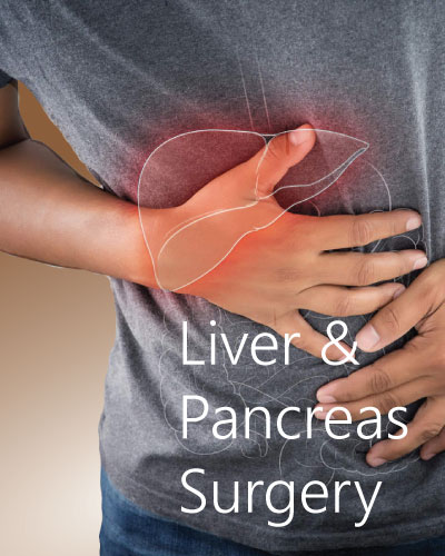 Pancreas Surgery